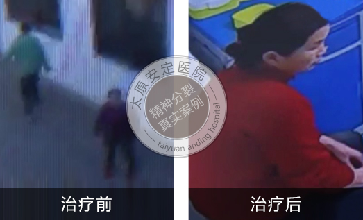 精神分裂症